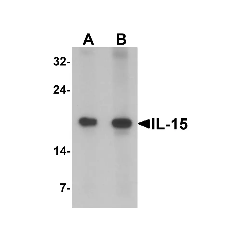 ProSci 7231_S IL-15 Antibody, ProSci, 0.02 mg/Unit Primary Image
