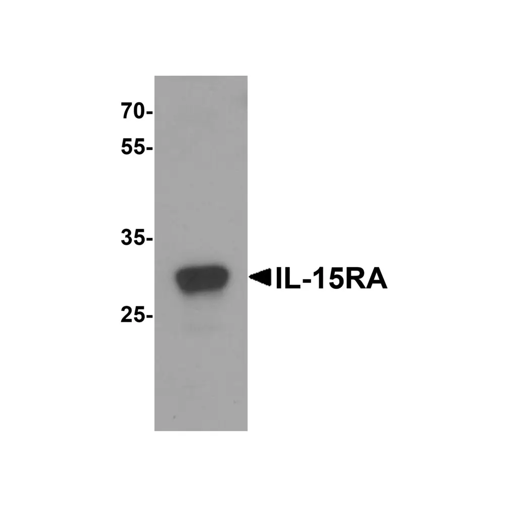 ProSci 7233 IL-15RA Antibody, ProSci, 0.1 mg/Unit Primary Image