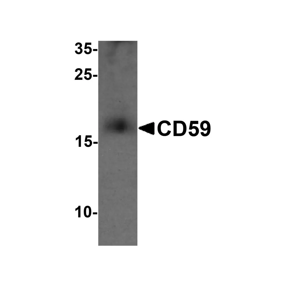 ProSci 7235_S CD59 Antibody, ProSci, 0.02 mg/Unit Primary Image