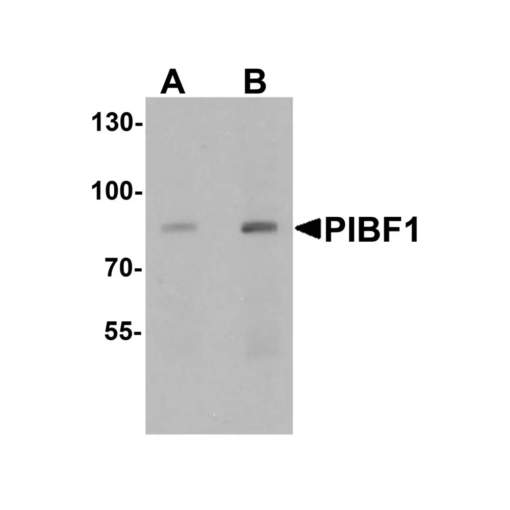 ProSci 7237 PIBF1 Antibody, ProSci, 0.1 mg/Unit Primary Image