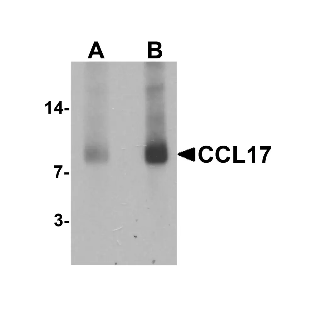 ProSci 7239 CCL17 Antibody, ProSci, 0.1 mg/Unit Primary Image