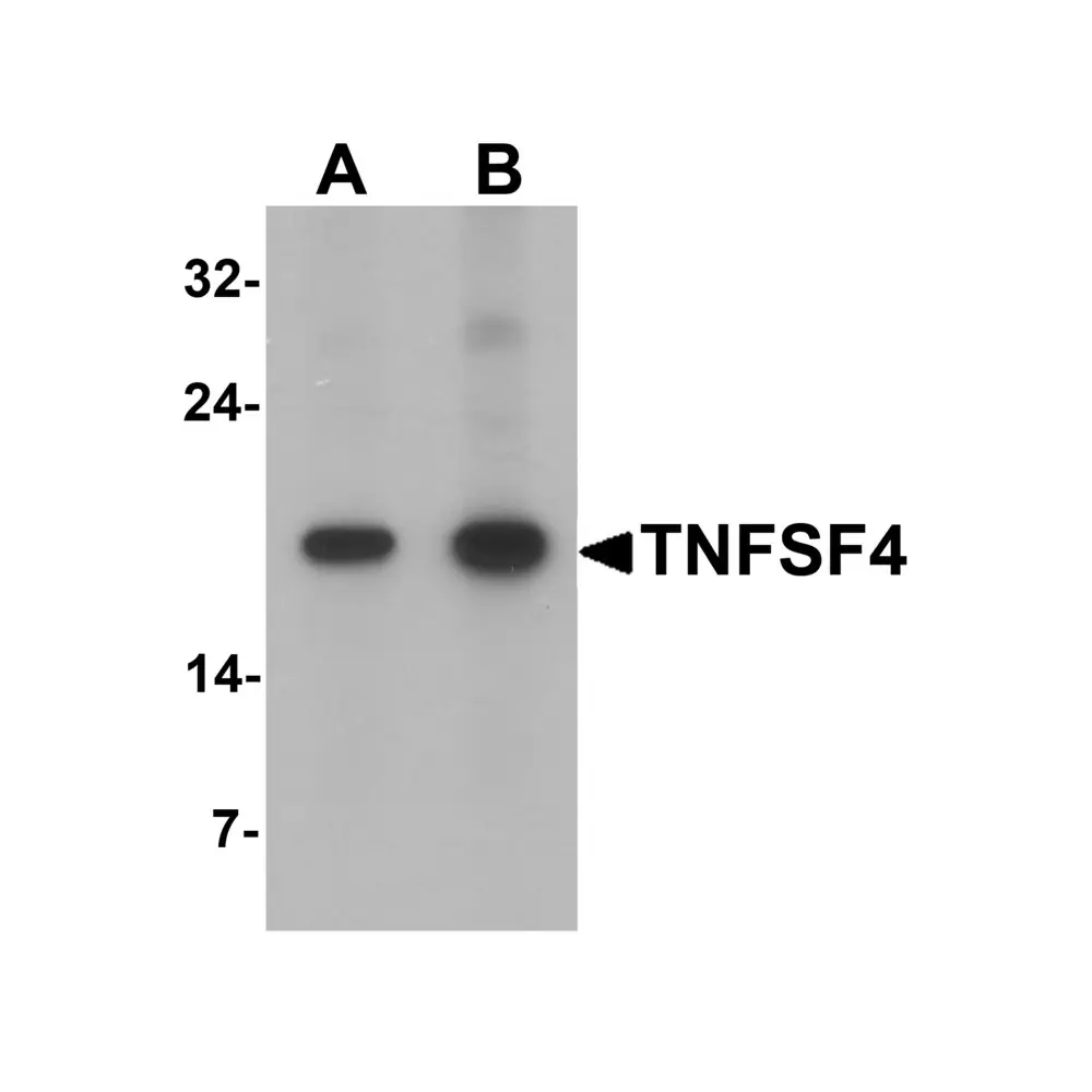 ProSci 7243 TNFSF4 Antibody, ProSci, 0.1 mg/Unit Primary Image
