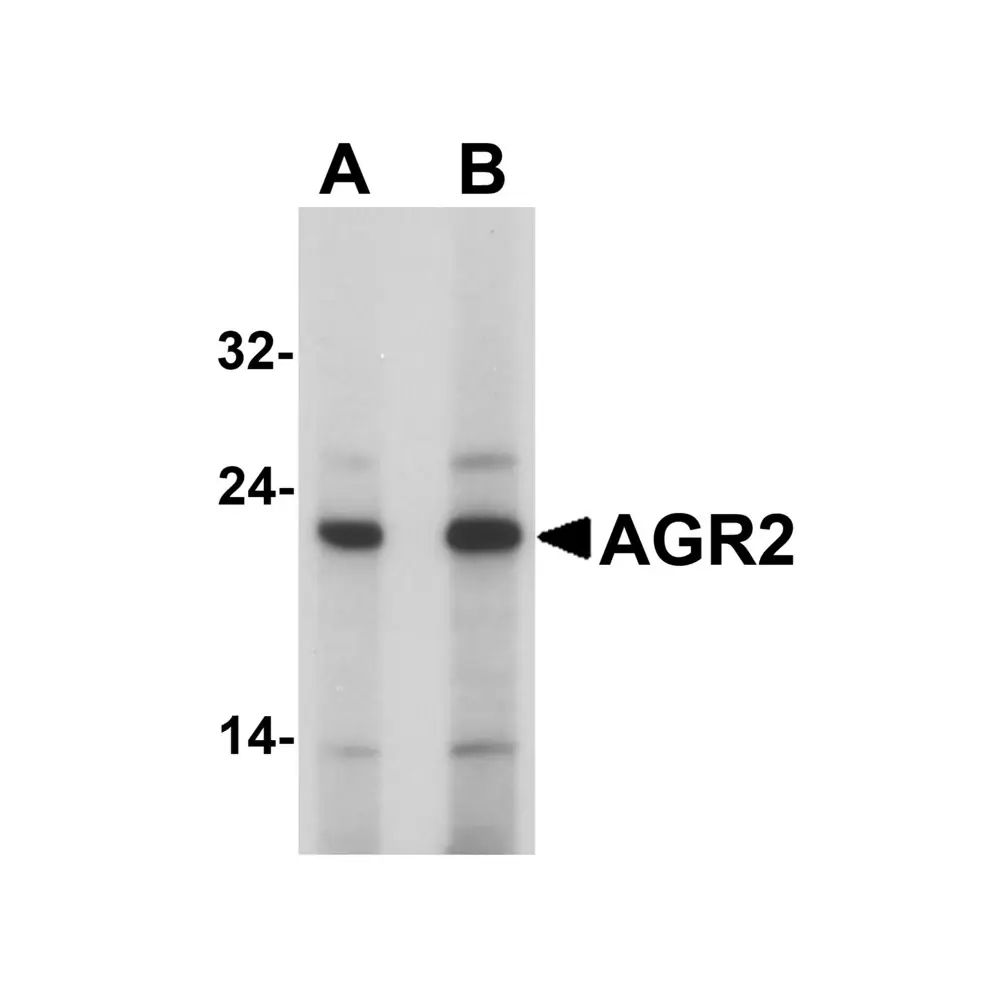ProSci 7247 AGR2 Antibody, ProSci, 0.1 mg/Unit Primary Image