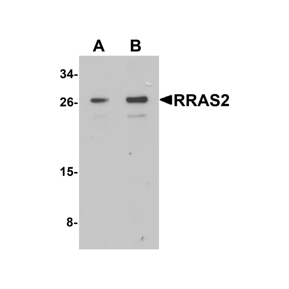 ProSci 7249 RRAS2 Antibody, ProSci, 0.1 mg/Unit Primary Image