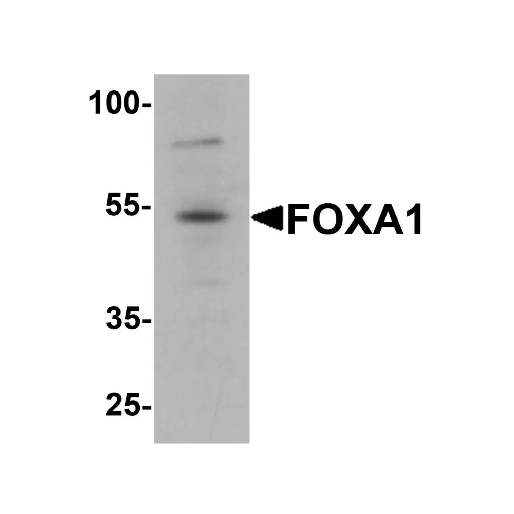 ProSci 7255_S FOXA1 Antibody, ProSci, 0.02 mg/Unit Primary Image