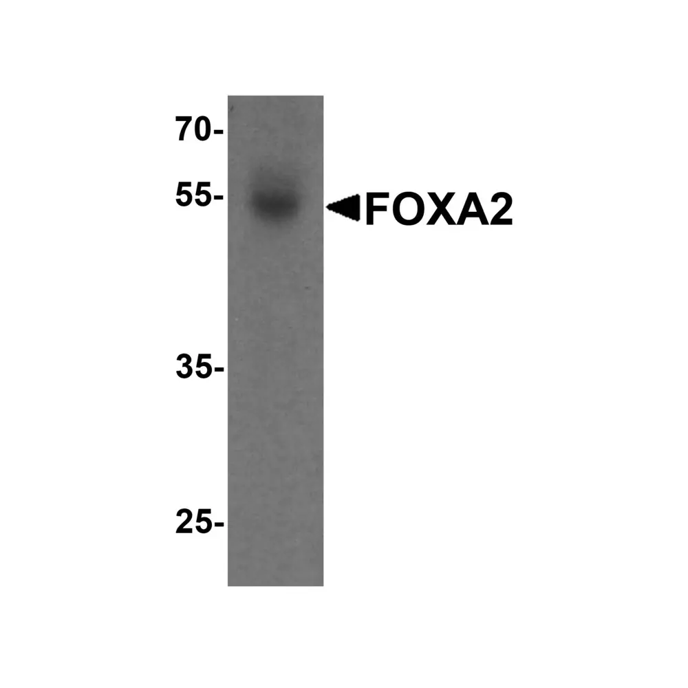 ProSci 7257_S FOXA2 Antibody, ProSci, 0.02 mg/Unit Primary Image
