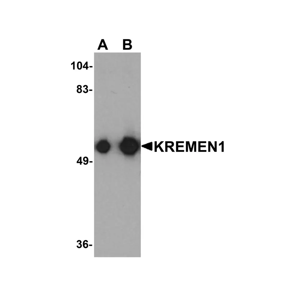 ProSci 7261 KREMEN1 Antibody, ProSci, 0.1 mg/Unit Primary Image