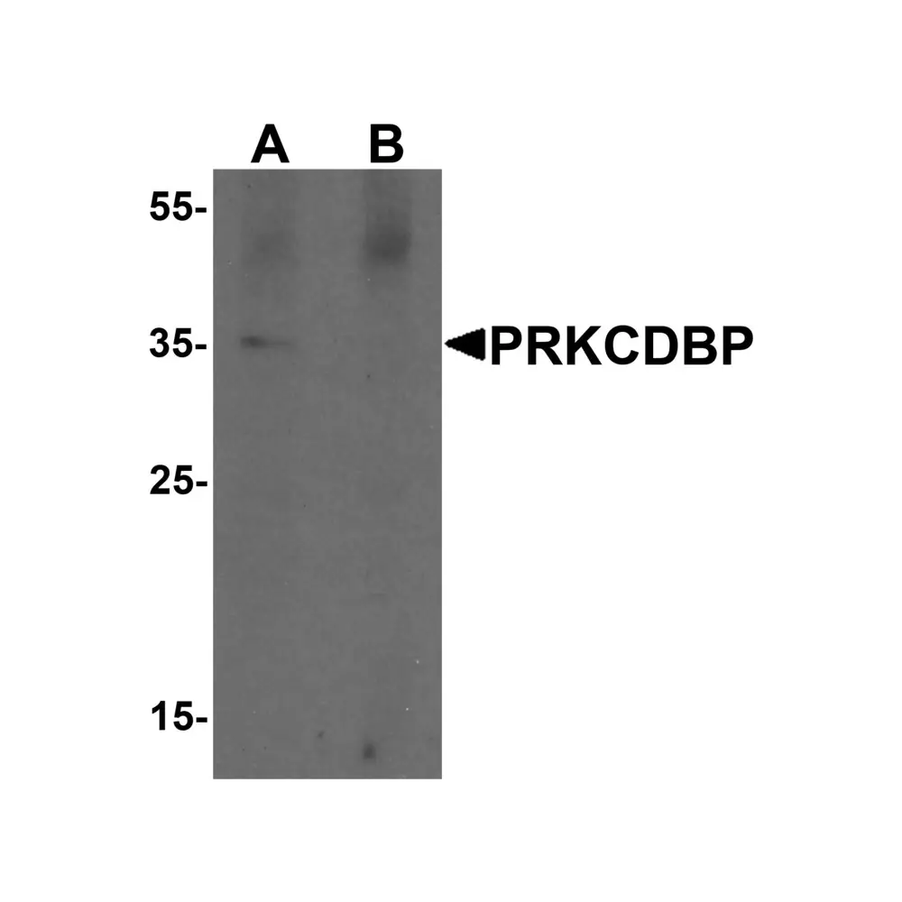 ProSci 7269 PRKCDBP Antibody, ProSci, 0.1 mg/Unit Primary Image