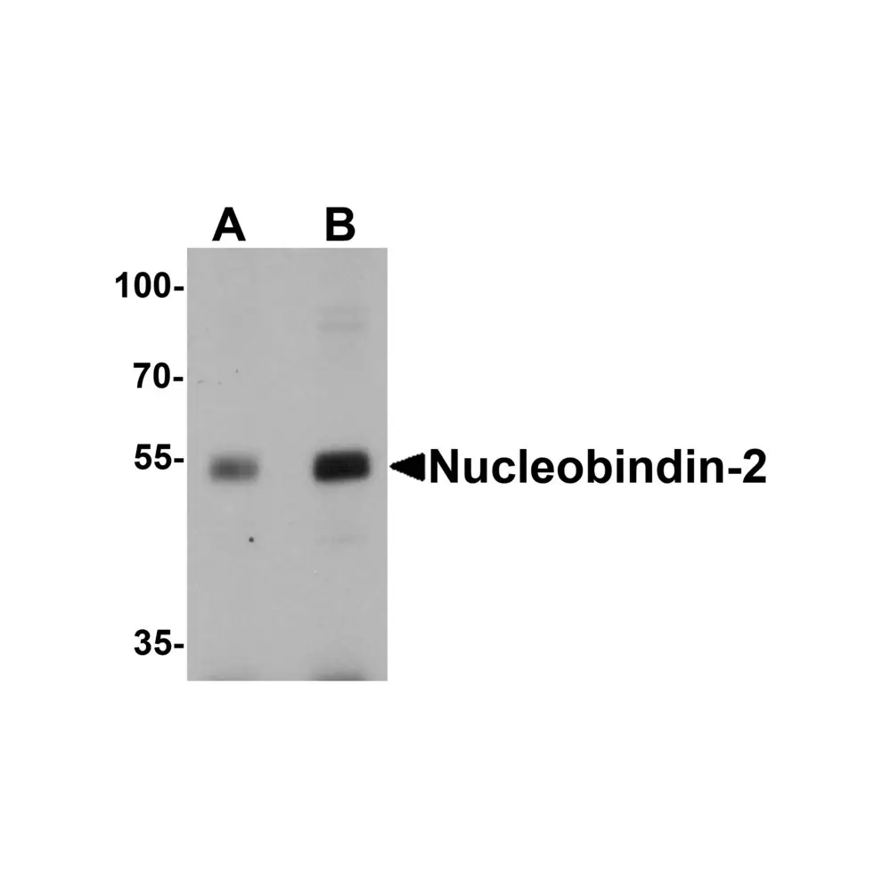 ProSci 7271_S Nucleobindin-2 Antibody, ProSci, 0.02 mg/Unit Primary Image