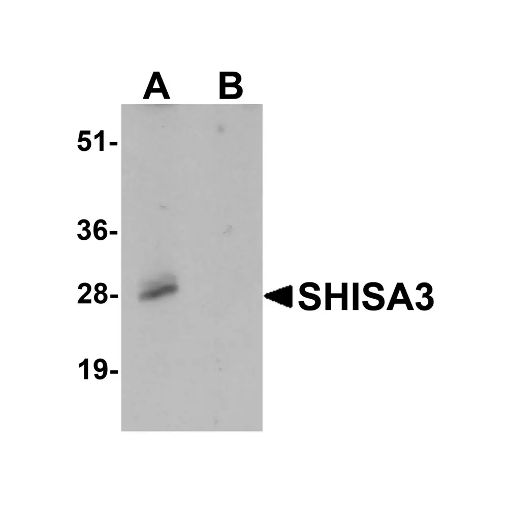 ProSci 7275_S SHISA3 Antibody, ProSci, 0.02 mg/Unit Primary Image