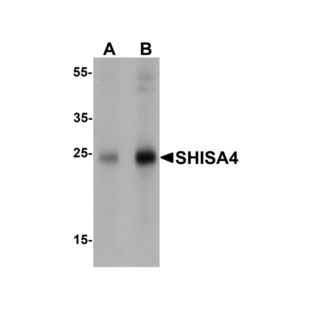 ProSci 7277_S SHISA4 Antibody, ProSci, 0.02 mg/Unit Primary Image