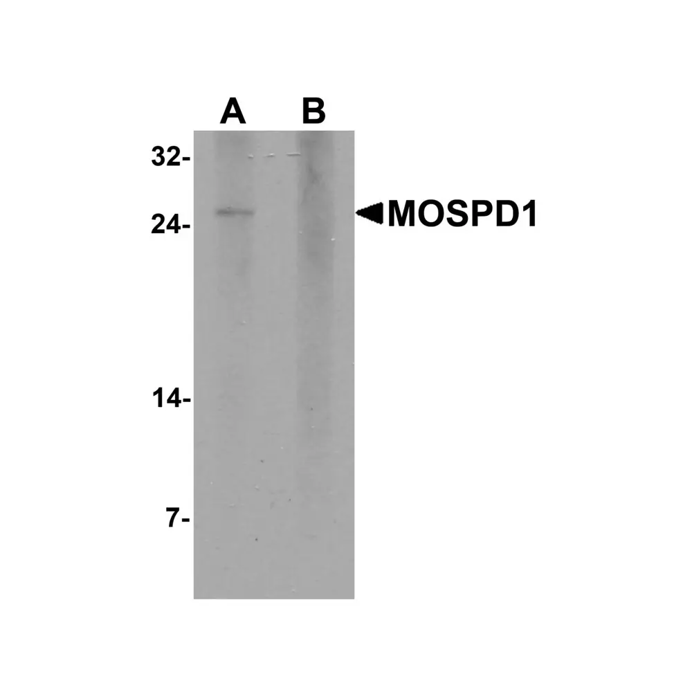 ProSci 7279 MOSPD1 Antibody, ProSci, 0.1 mg/Unit Primary Image
