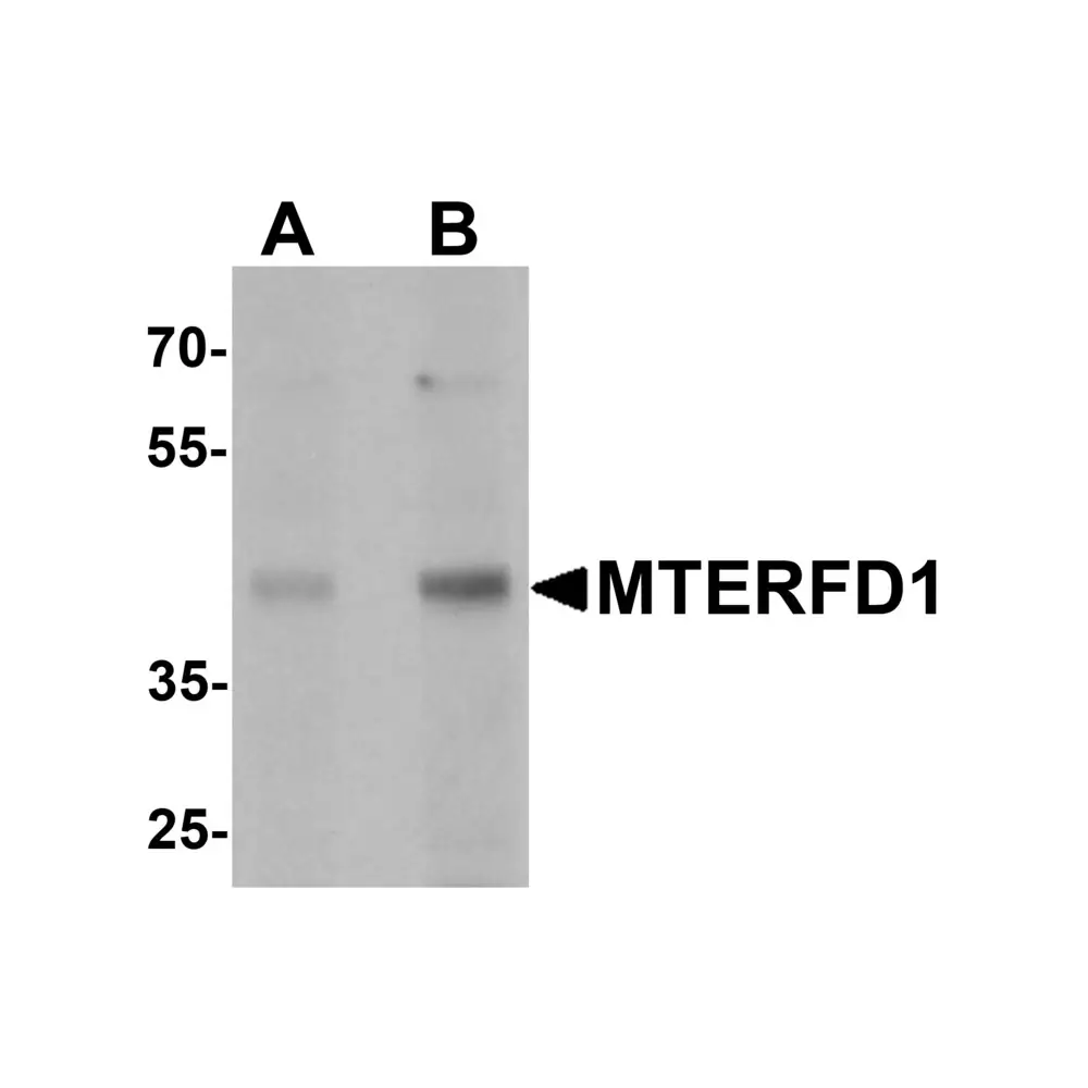 ProSci 7281 MTERFD1 Antibody, ProSci, 0.1 mg/Unit Primary Image