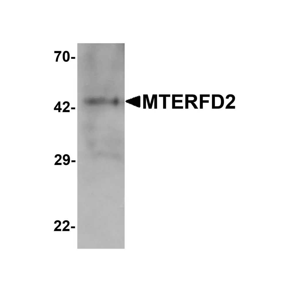 ProSci 7283_S MTERFD2 Antibody, ProSci, 0.02 mg/Unit Primary Image