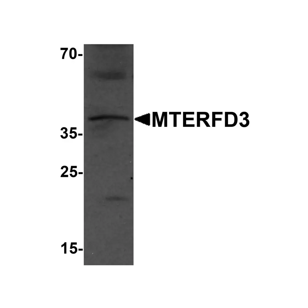 ProSci 7285 MTERFD3 Antibody, ProSci, 0.1 mg/Unit Primary Image