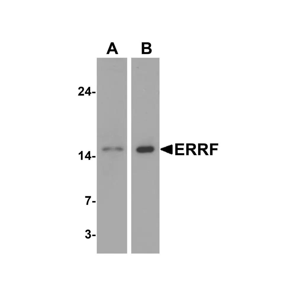 ProSci 7289 ERRF Antibody, ProSci, 0.1 mg/Unit Primary Image