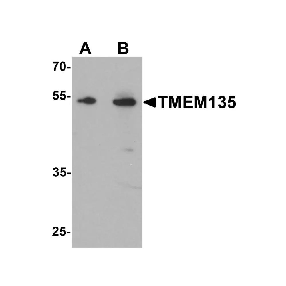 ProSci 7291 TMEM135 Antibody, ProSci, 0.1 mg/Unit Primary Image