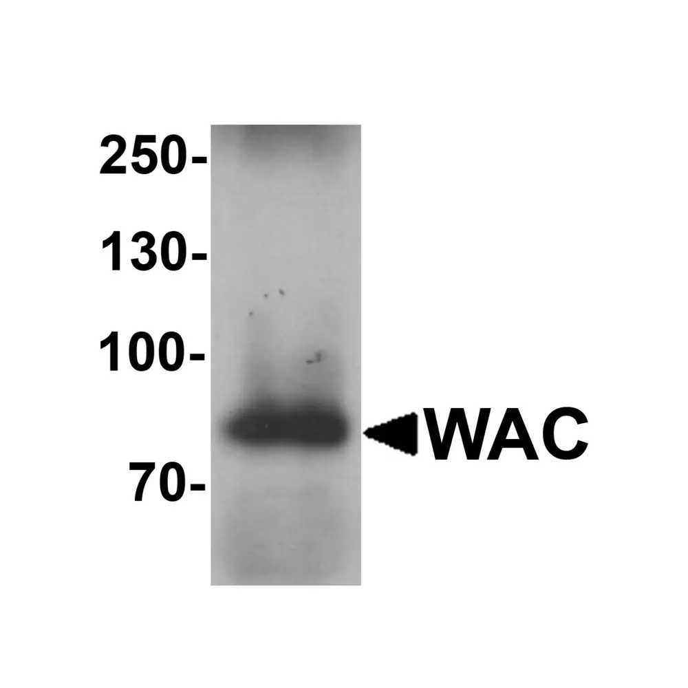 ProSci 7293 WAC Antibody, ProSci, 0.1 mg/Unit Primary Image