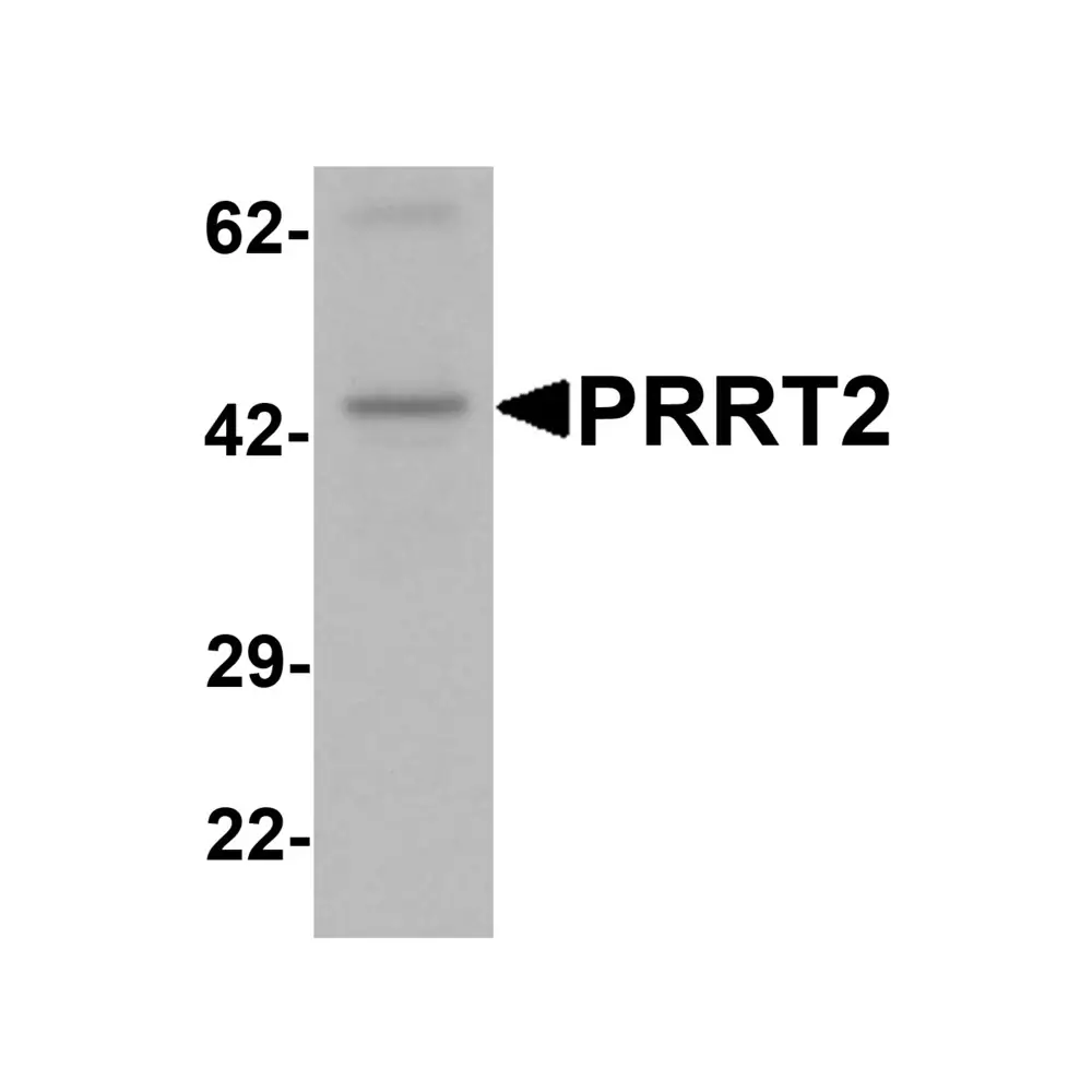 ProSci 7295 PRRT2 Antibody, ProSci, 0.1 mg/Unit Primary Image