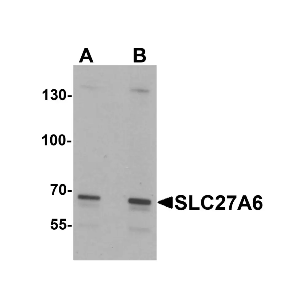 ProSci 7297 SLC27A6 Antibody, ProSci, 0.1 mg/Unit Primary Image