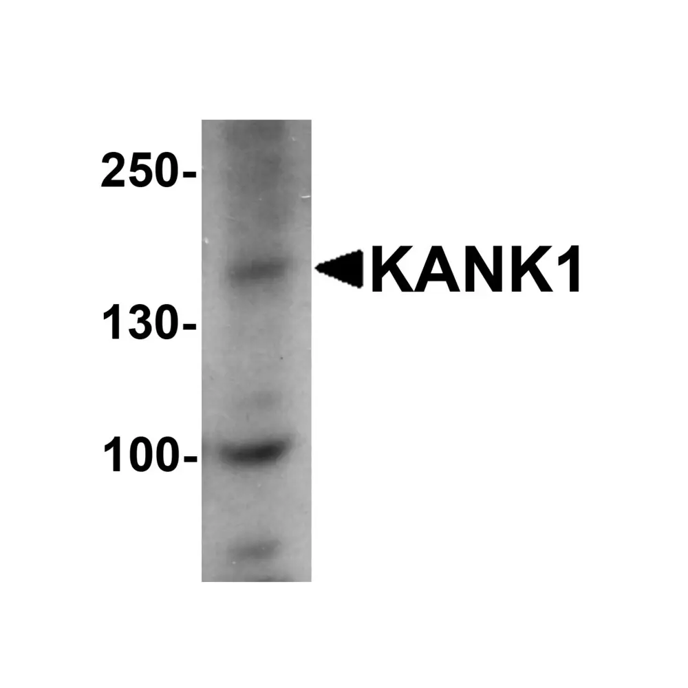 ProSci 7307 KANK1 Antibody, ProSci, 0.1 mg/Unit Primary Image