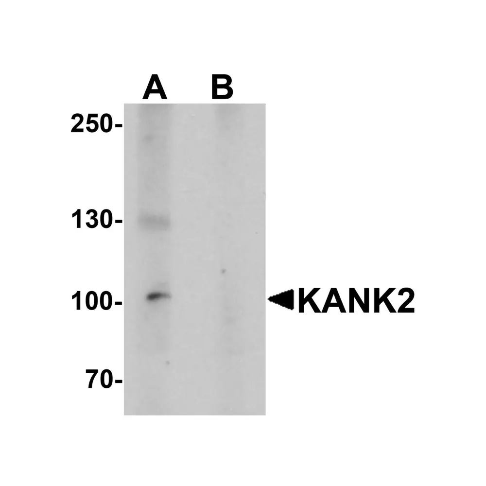 ProSci 7309 KANK2 Antibody, ProSci, 0.1 mg/Unit Primary Image