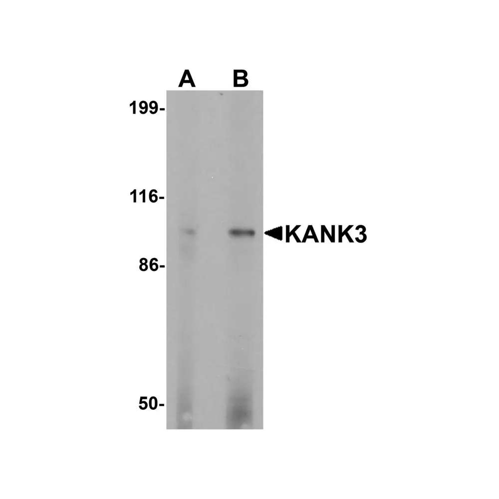 ProSci 7311 KANK3 Antibody, ProSci, 0.1 mg/Unit Primary Image