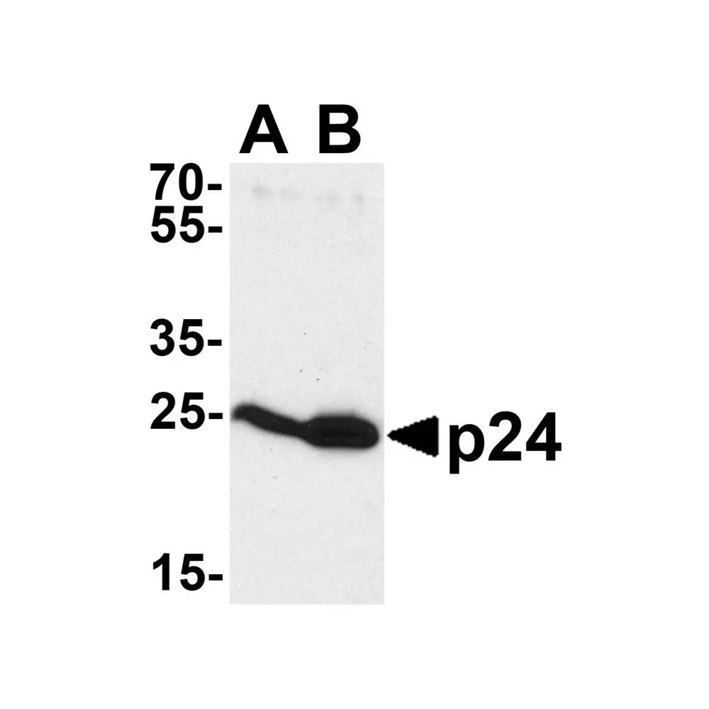 ProSci 7313 HIV-1 p24 Antibody, ProSci, 0.1 mg/Unit Primary Image