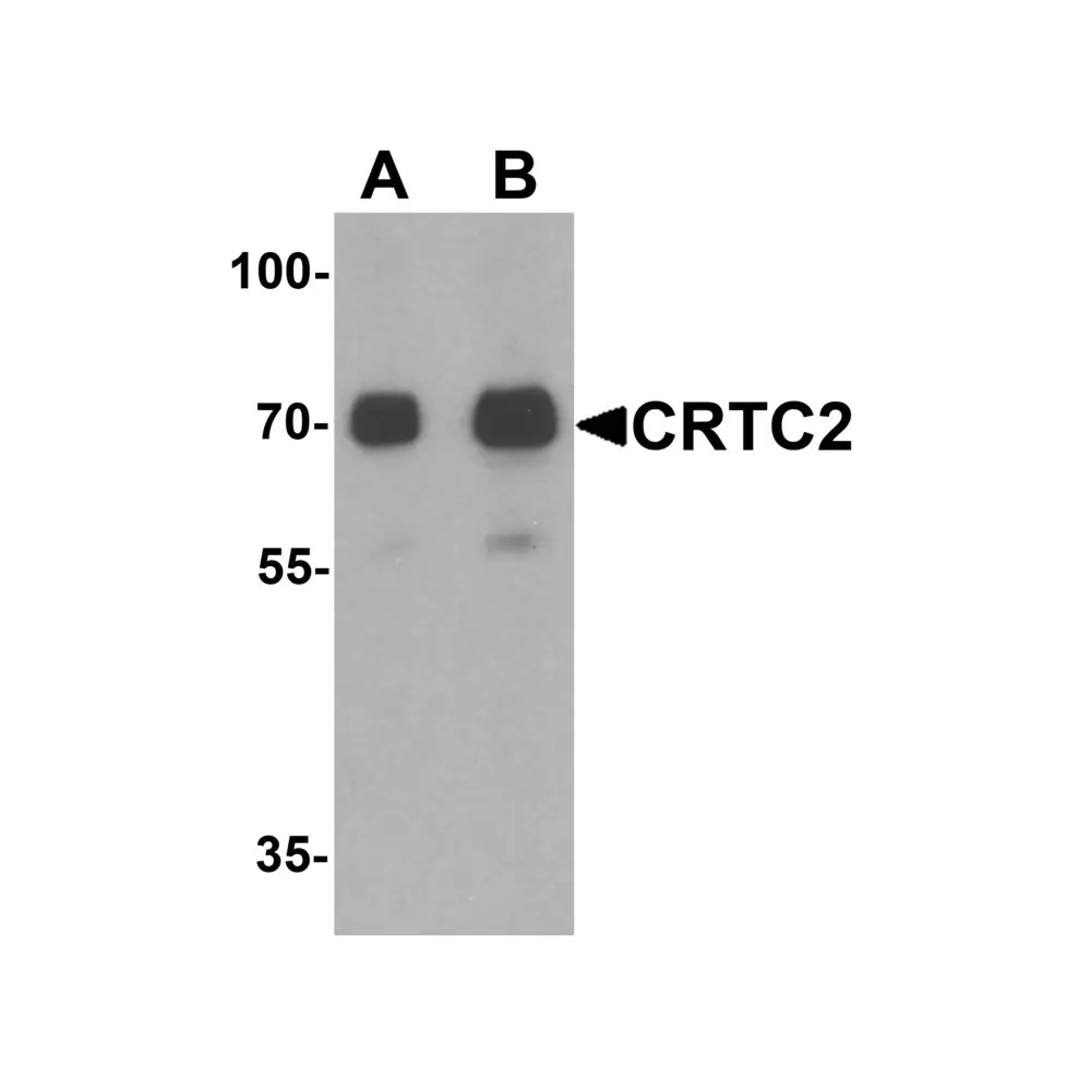 ProSci 7325_S CRTC2 Antibody, ProSci, 0.02 mg/Unit Primary Image