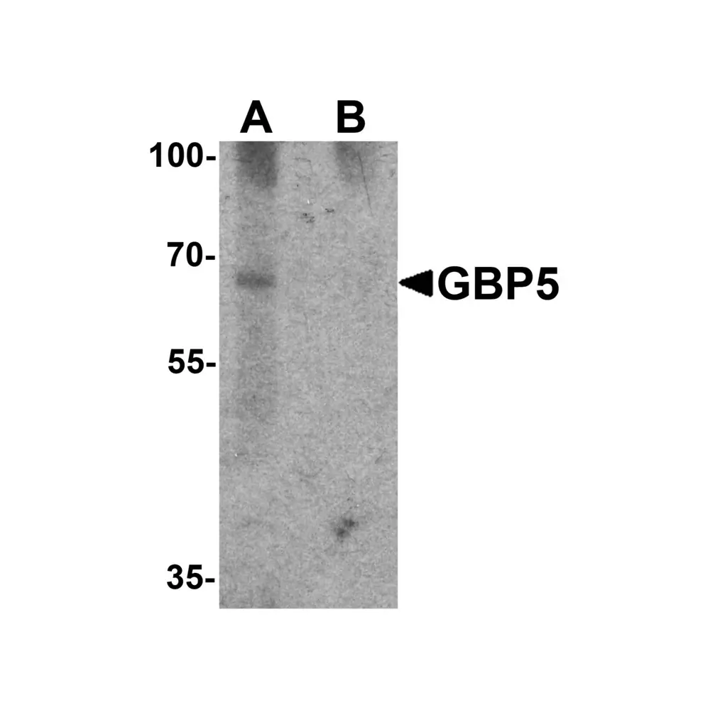 ProSci 7327 GBP5 Antibody, ProSci, 0.1 mg/Unit Primary Image