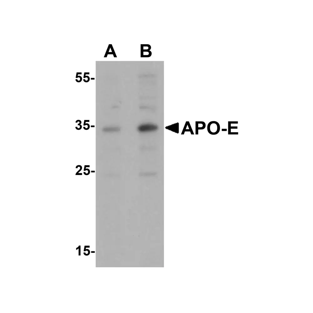 ProSci 7333 APO-E Antibody, ProSci, 0.1 mg/Unit Primary Image