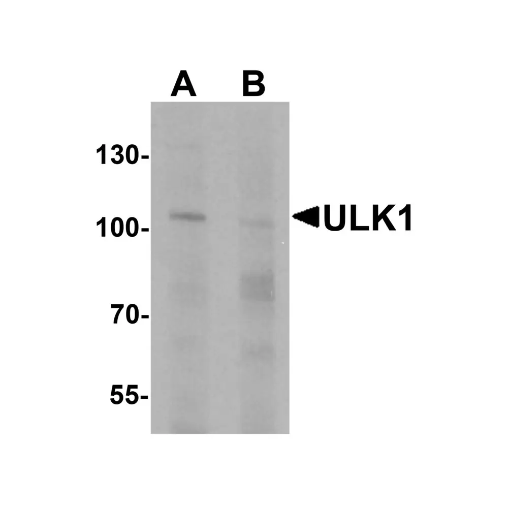 ProSci 7335 ULK1 Antibody, ProSci, 0.1 mg/Unit Primary Image