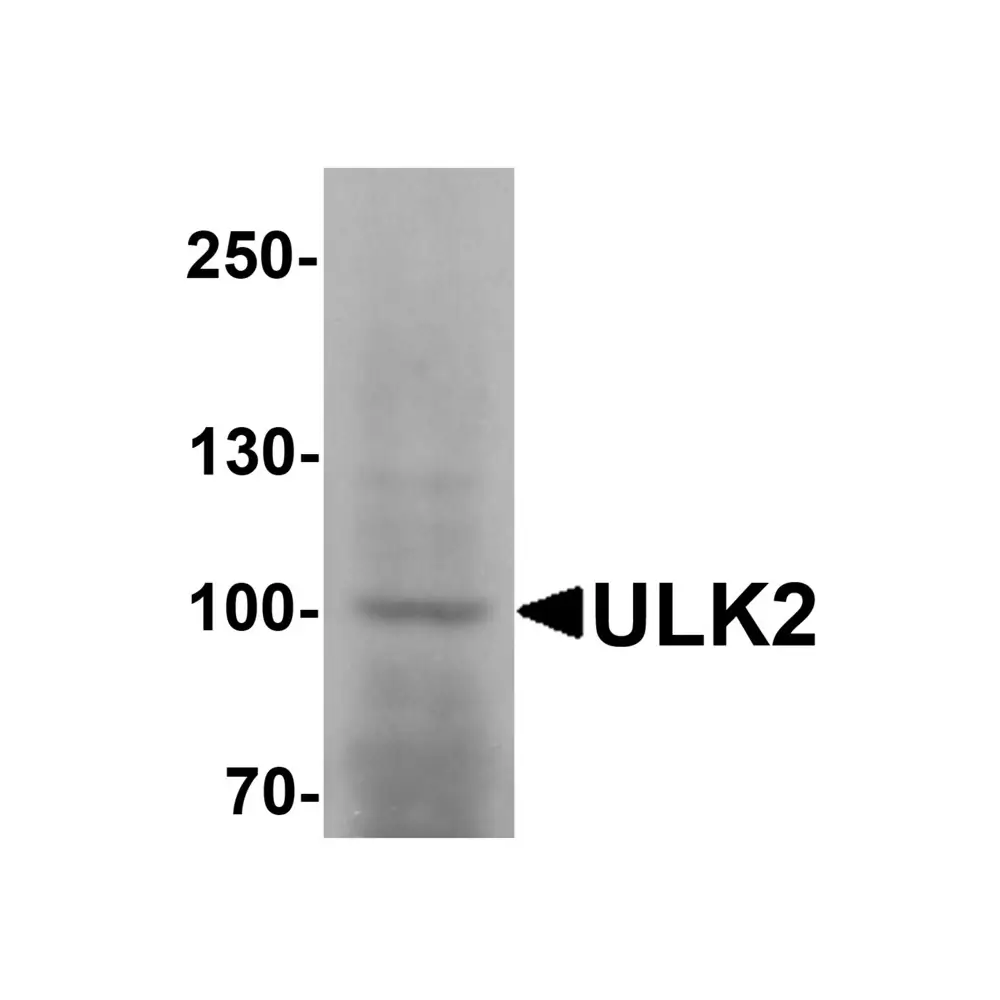 ProSci 7337 ULK2 Antibody, ProSci, 0.1 mg/Unit Primary Image