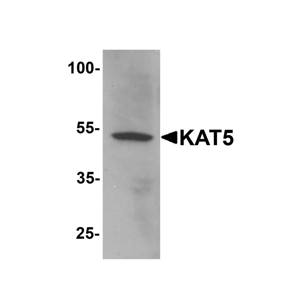 ProSci 7339 KAT5 Antibody, ProSci, 0.1 mg/Unit Primary Image