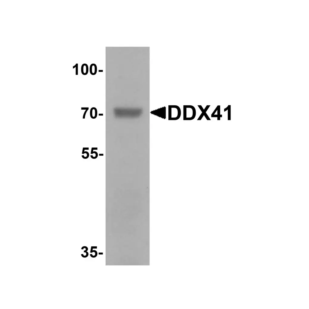 ProSci 7349 DDX41 Antibody, ProSci, 0.1 mg/Unit Primary Image