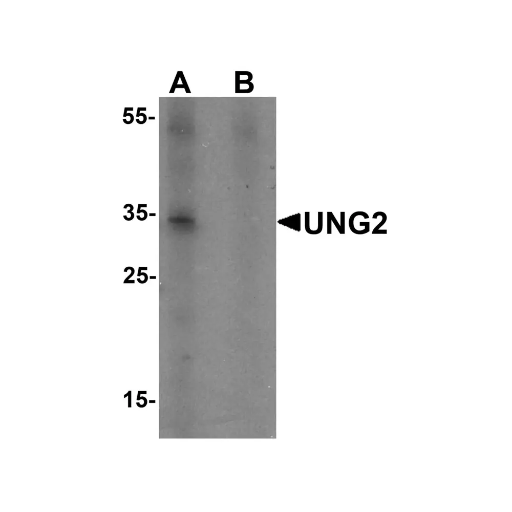 ProSci 7353 UNG2 Antibody, ProSci, 0.1 mg/Unit Primary Image