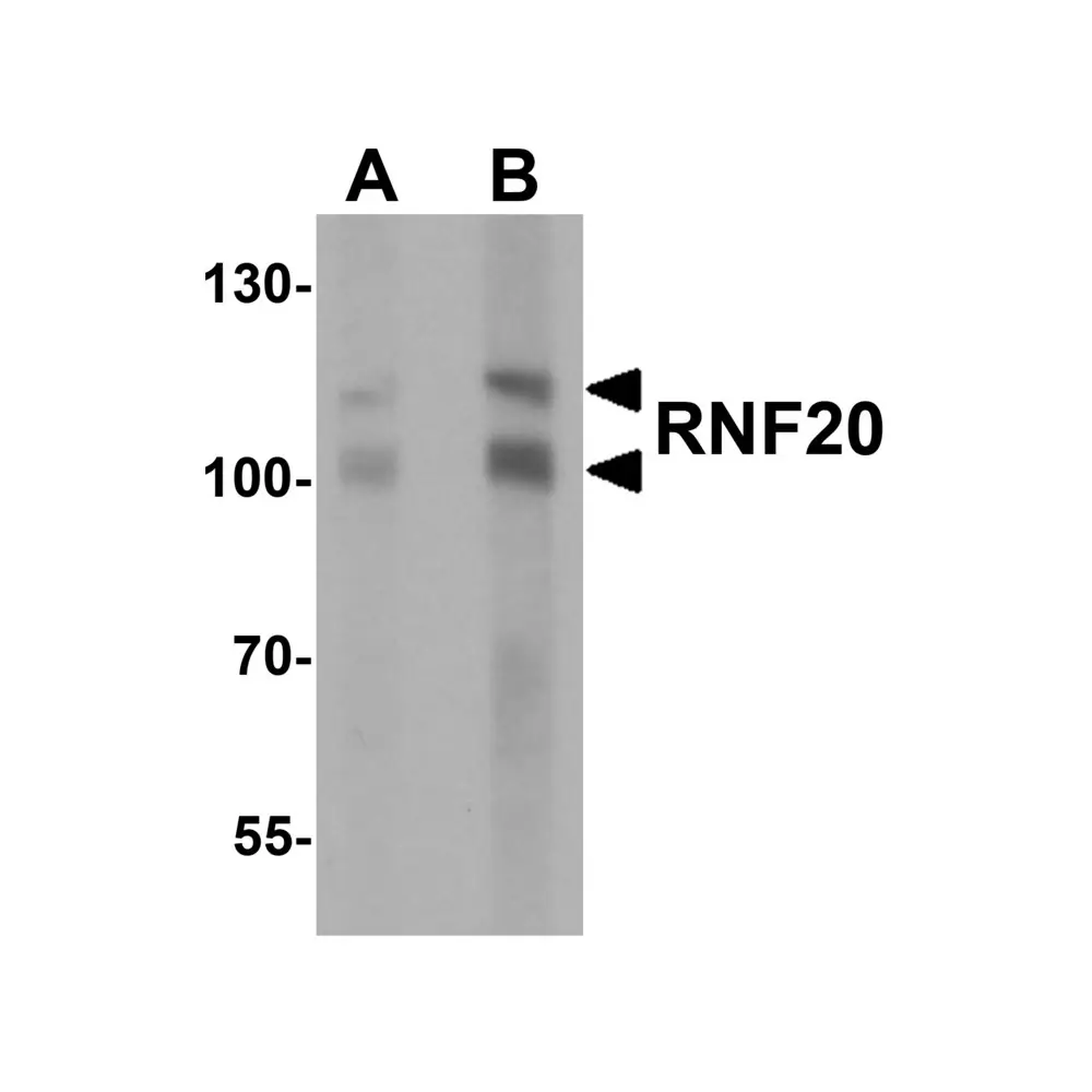 ProSci 7357 RNF20 Antibody, ProSci, 0.1 mg/Unit Primary Image