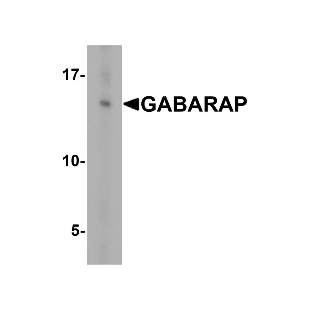 ProSci 7359_S GABARAP Antibody, ProSci, 0.02 mg/Unit Primary Image