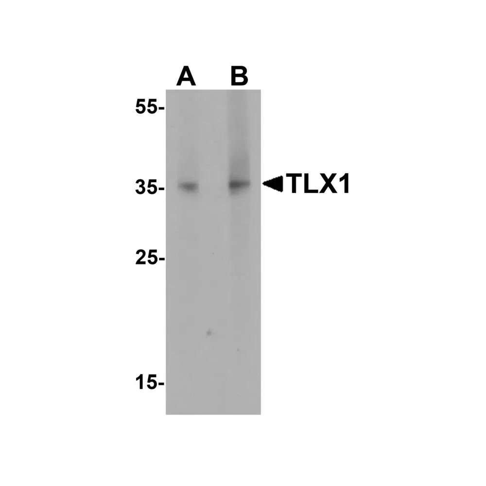 ProSci 7361 TLX1 Antibody, ProSci, 0.1 mg/Unit Primary Image