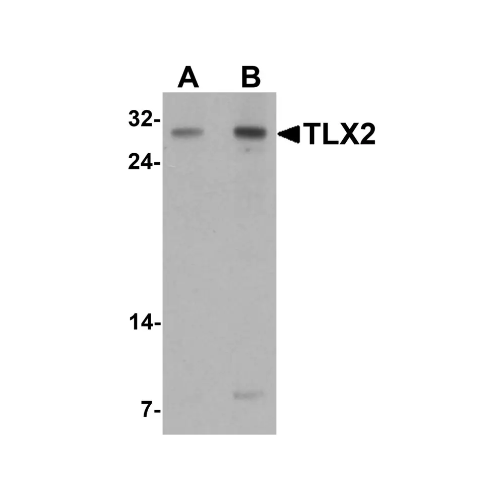 ProSci 7373 TLX2 Antibody, ProSci, 0.1 mg/Unit Primary Image
