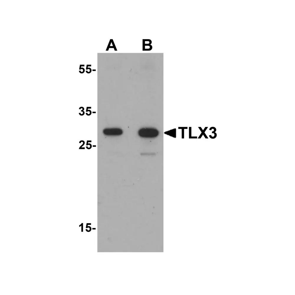 ProSci 7375 TLX3 Antibody, ProSci, 0.1 mg/Unit Primary Image