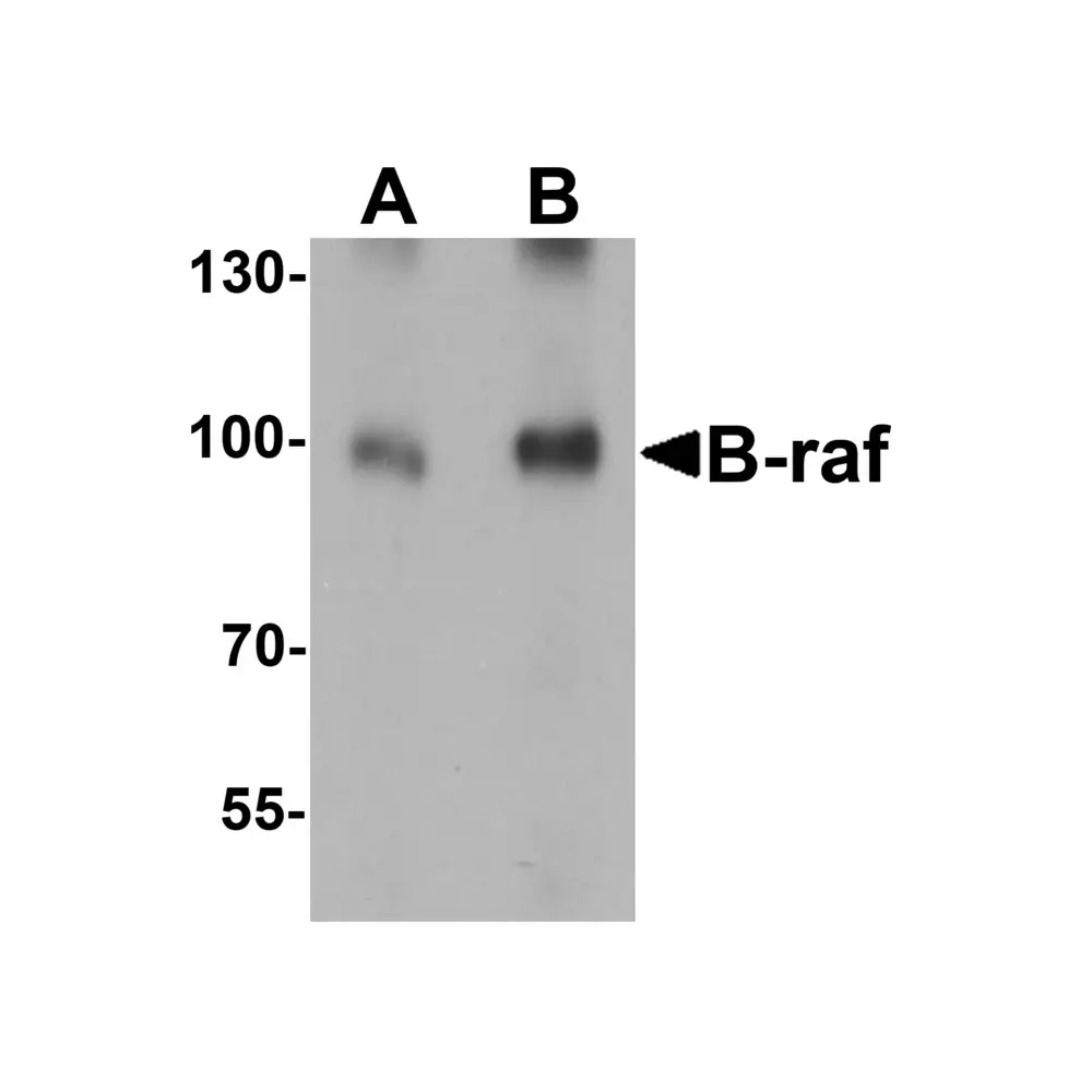 ProSci 7379 B-raf Antibody, ProSci, 0.1 mg/Unit Primary Image