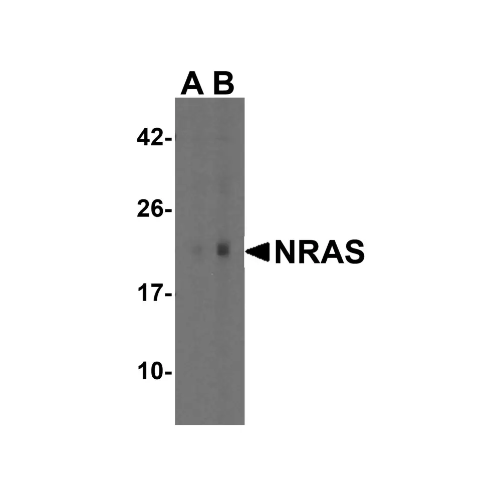 ProSci 7381_S N-RAS Antibody, ProSci, 0.02 mg/Unit Primary Image