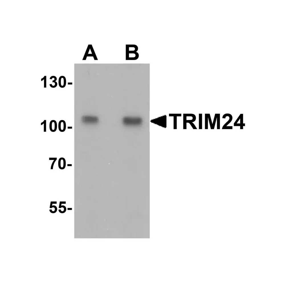 ProSci 7383 TRIM24 Antibody, ProSci, 0.1 mg/Unit Primary Image