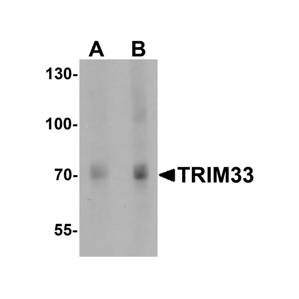 ProSci 7385_S TRIM33 Antibody, ProSci, 0.02 mg/Unit Primary Image