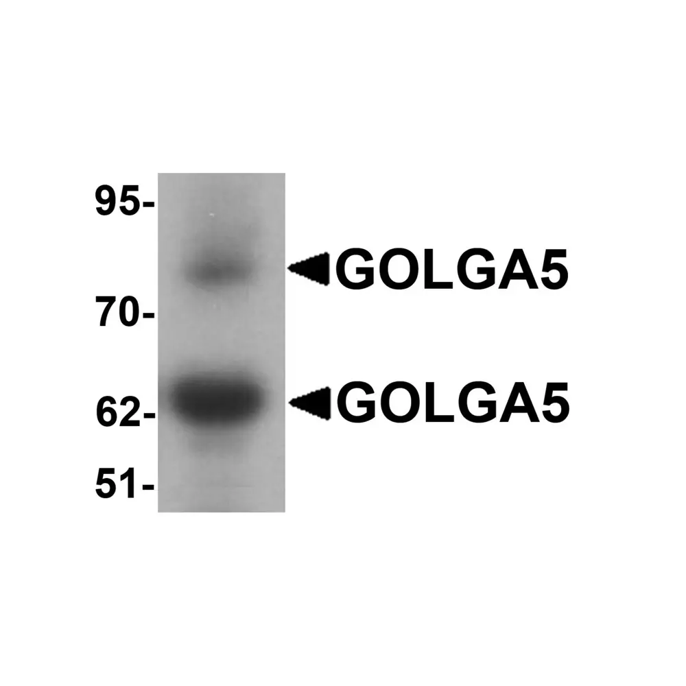 ProSci 7387 GOLGA5 Antibody, ProSci, 0.1 mg/Unit Primary Image