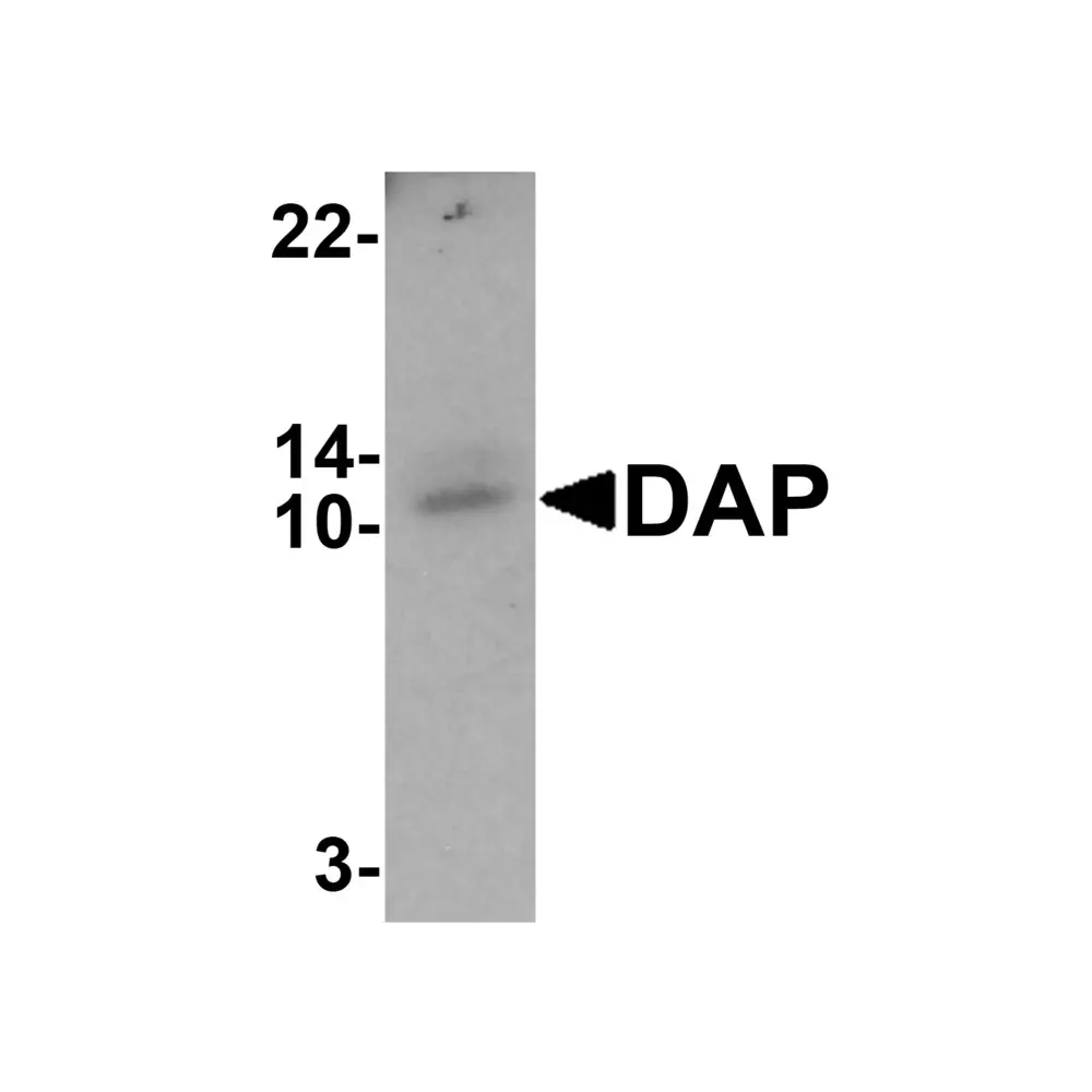 ProSci 7389_S DAP Antibody, ProSci, 0.02 mg/Unit Primary Image