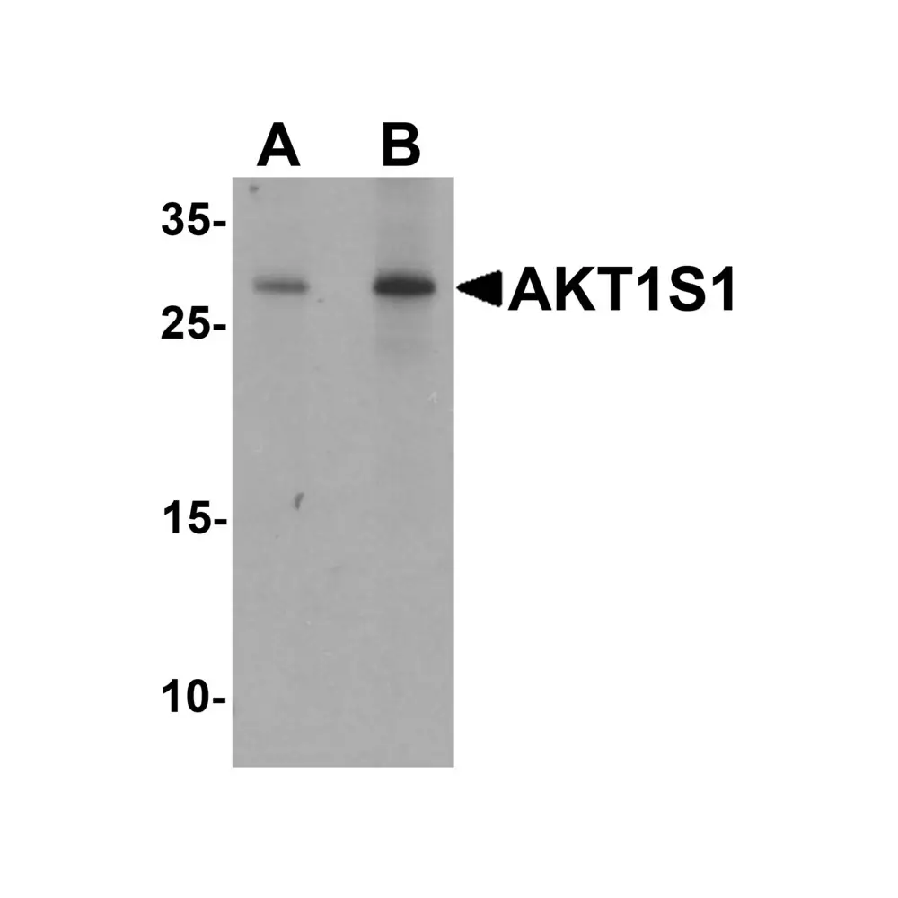 ProSci 7391 AKT1S1 Antibody, ProSci, 0.1 mg/Unit Primary Image