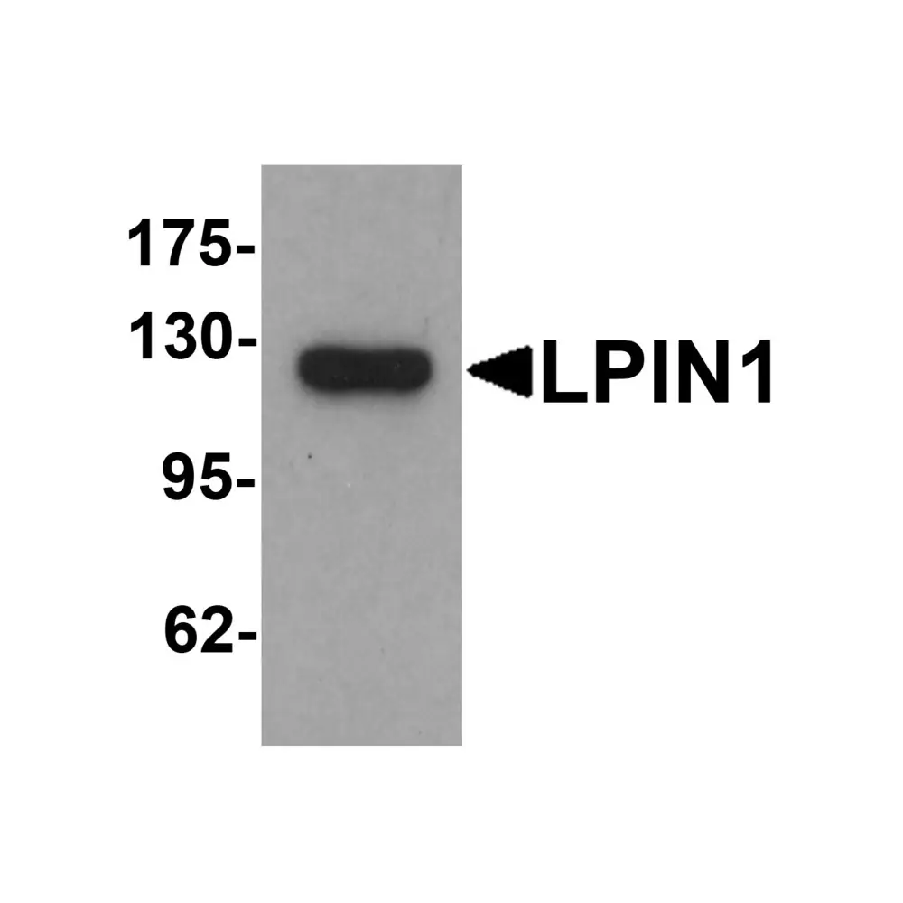 ProSci 7393 LPIN1 Antibody, ProSci, 0.1 mg/Unit Primary Image