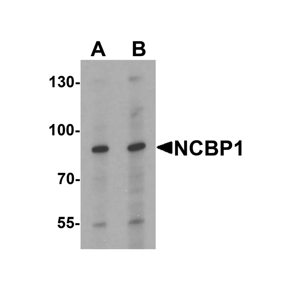 ProSci 7395_S NCBP1 Antibody, ProSci, 0.02 mg/Unit Primary Image